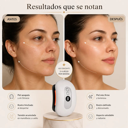 Masajeador Gua Sha con Radiofrecuencia facial